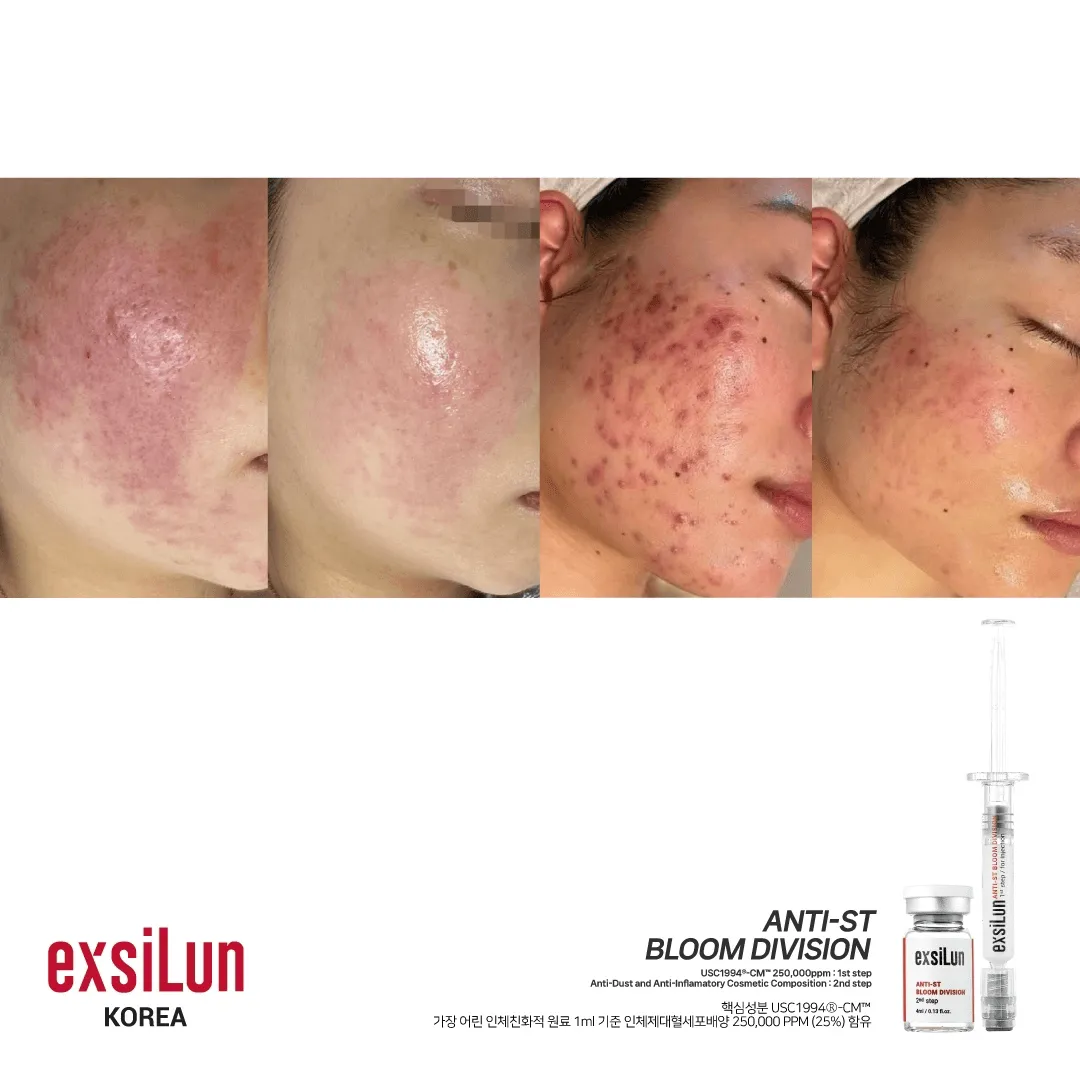 [Mua Place] Facial Treatment & Skin Care in Gangnam, Seoul