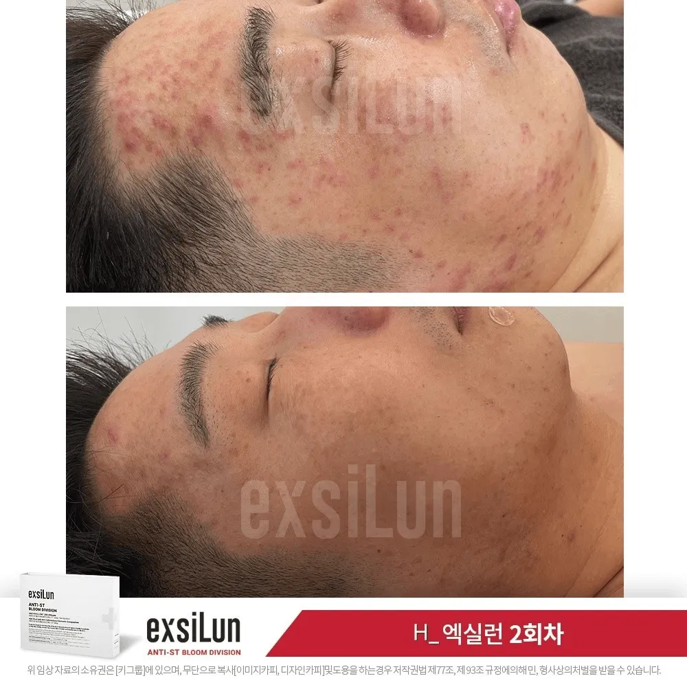 [Mua Place] Facial Treatment & Skin Care in Gangnam, Seoul